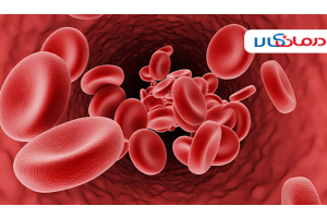 انواع تالاسمی و کم خونی و روش درمان آن