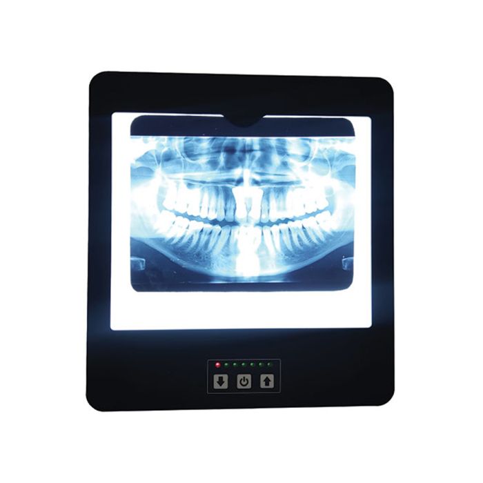 MOONLIGHT-NEGATOSCOPE-Dentist-OPG-1