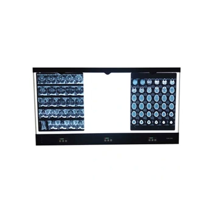 پیش فریم نگاتوسکوپ توکار سه خانه PVC مون لایت 