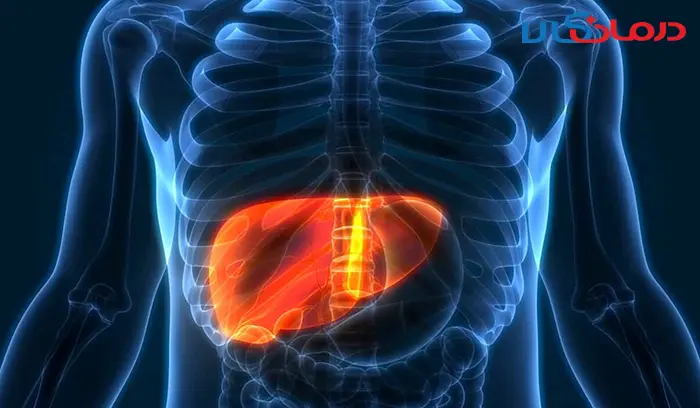گرید های کبد چرب چیست؟ + راه های درمان کبد چرب