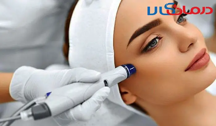 عکس های لیفت صورت با نخ