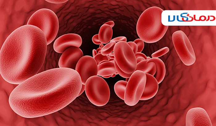 انواع تالاسمی و کم خونی و روش درمان آن