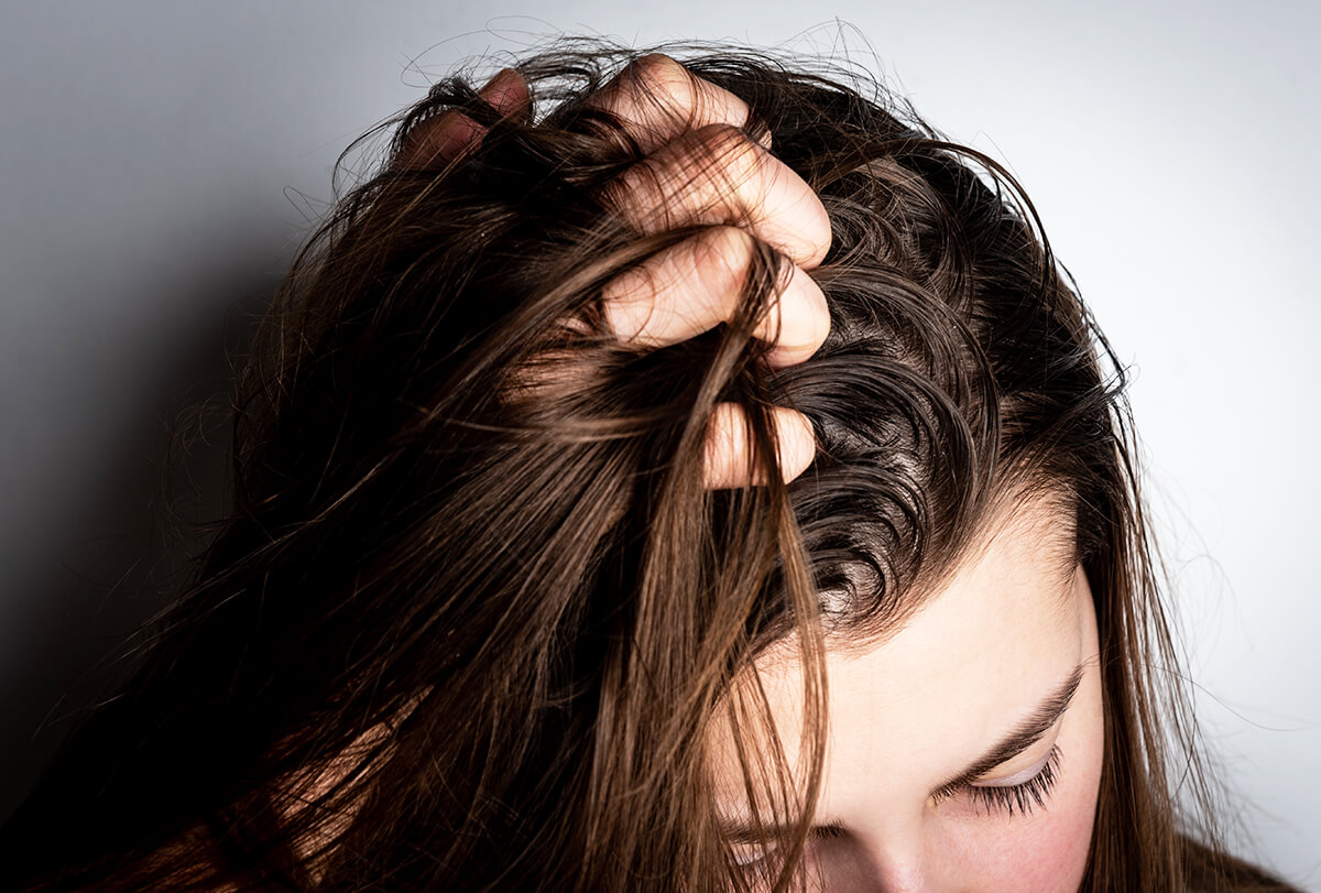 درمان چربی موی سر