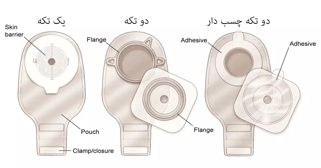 کیسه کلستومی