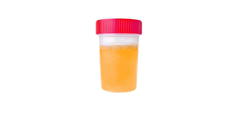 orange-urine