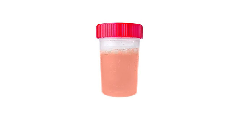 pink urine
