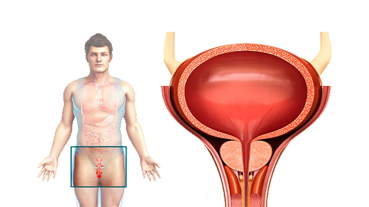 پروستات چیست و چگونه درمان می شود؟