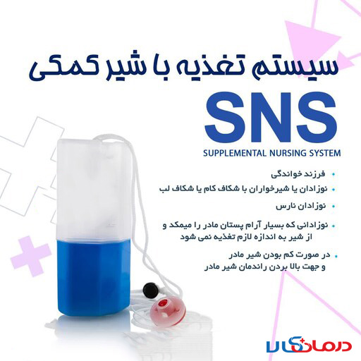 sns چیست و چگونه آن را بسازیم